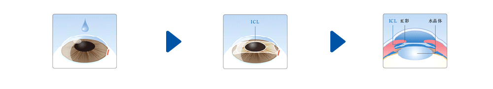 icl-image1